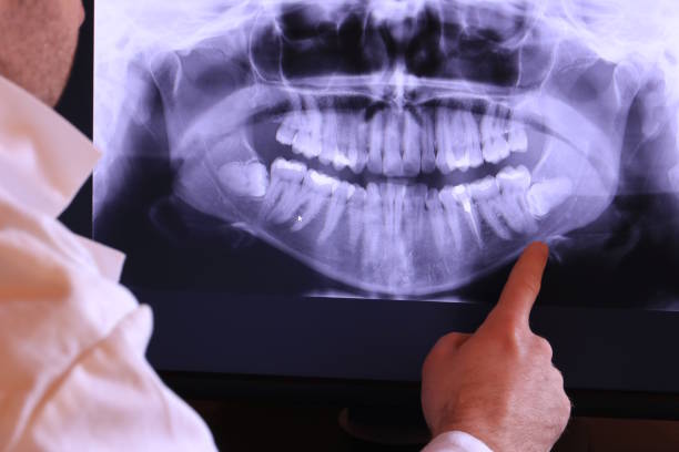 Professional Emergency Dentist in IA